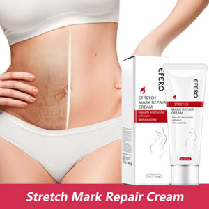 EFERO Repair Cream Removal Scar Stretch Marks  Treatment  Postpartum Maternity Skin Solution Body Creams